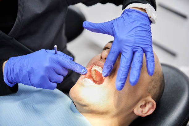 Best Emergency Root Canal Treatment in Cedar Hills, OR